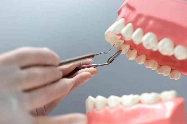 Dental Bonding