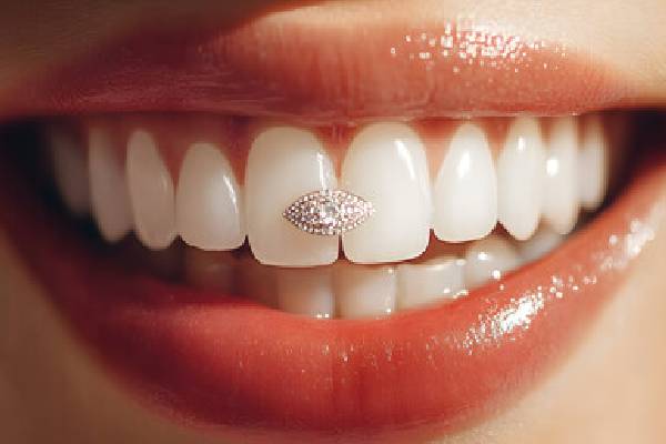 Tooth Jewellery
